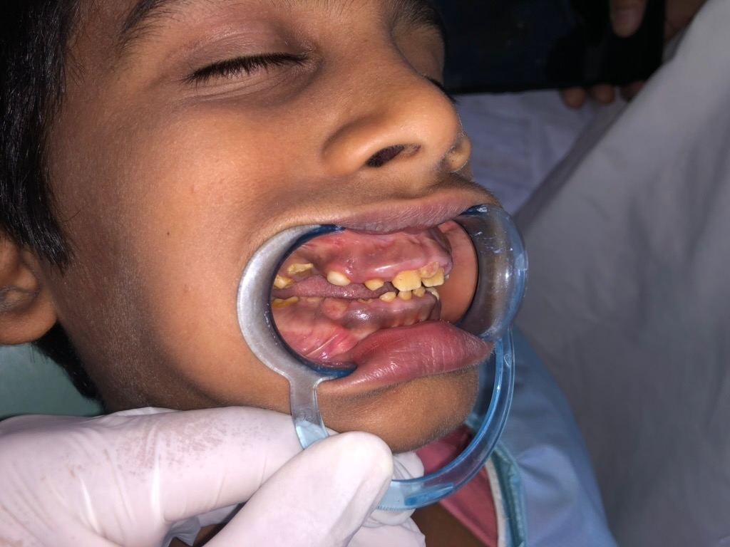 Pre-operative left side view