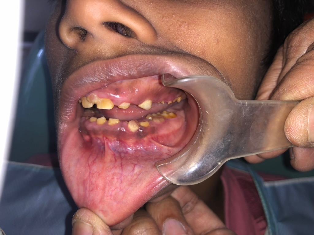 Pre-operative right side view