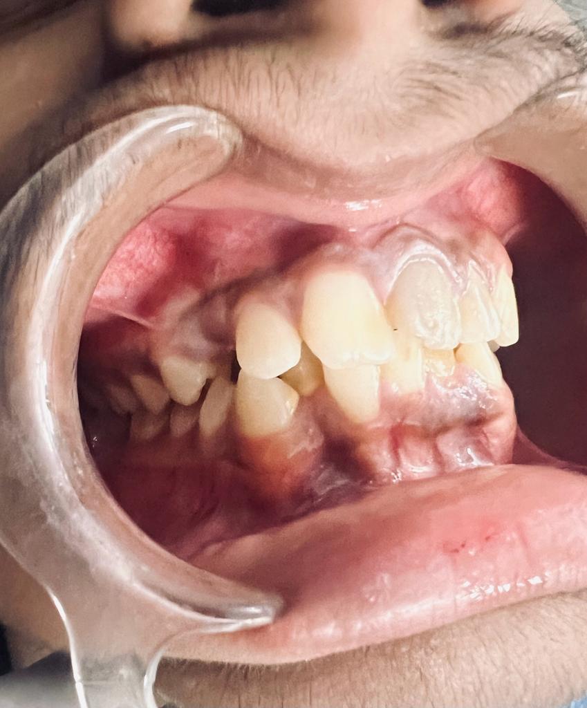 Treatment journey step 1 — Initial consultation