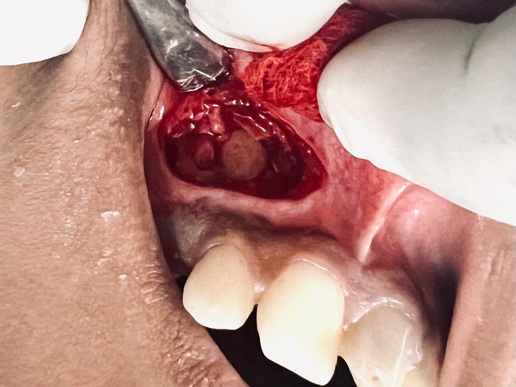 Treatment journey step 2 — Pre-treatment evaluation