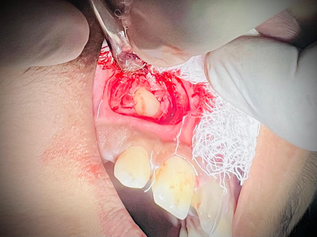 Treatment journey step 3 — Treatment begins