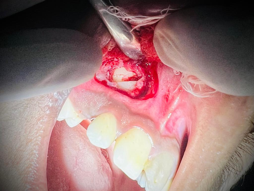 Treatment journey step 4 — Mid-treatment progress