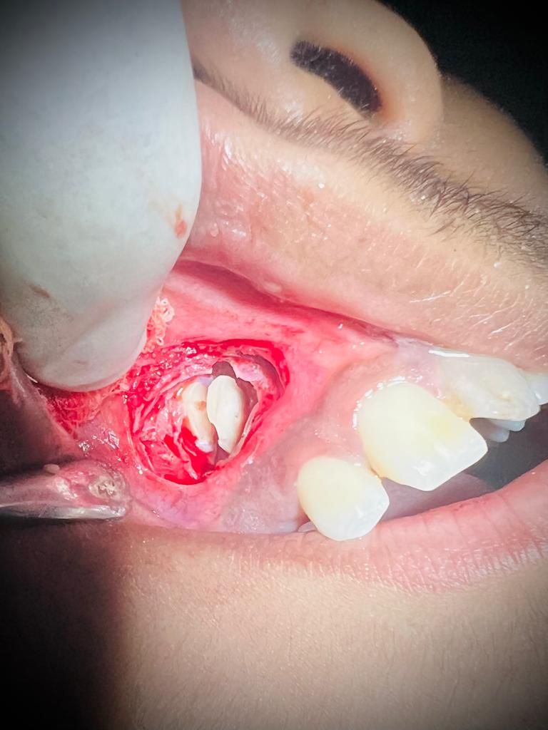 Treatment journey step 5 — Key milestone