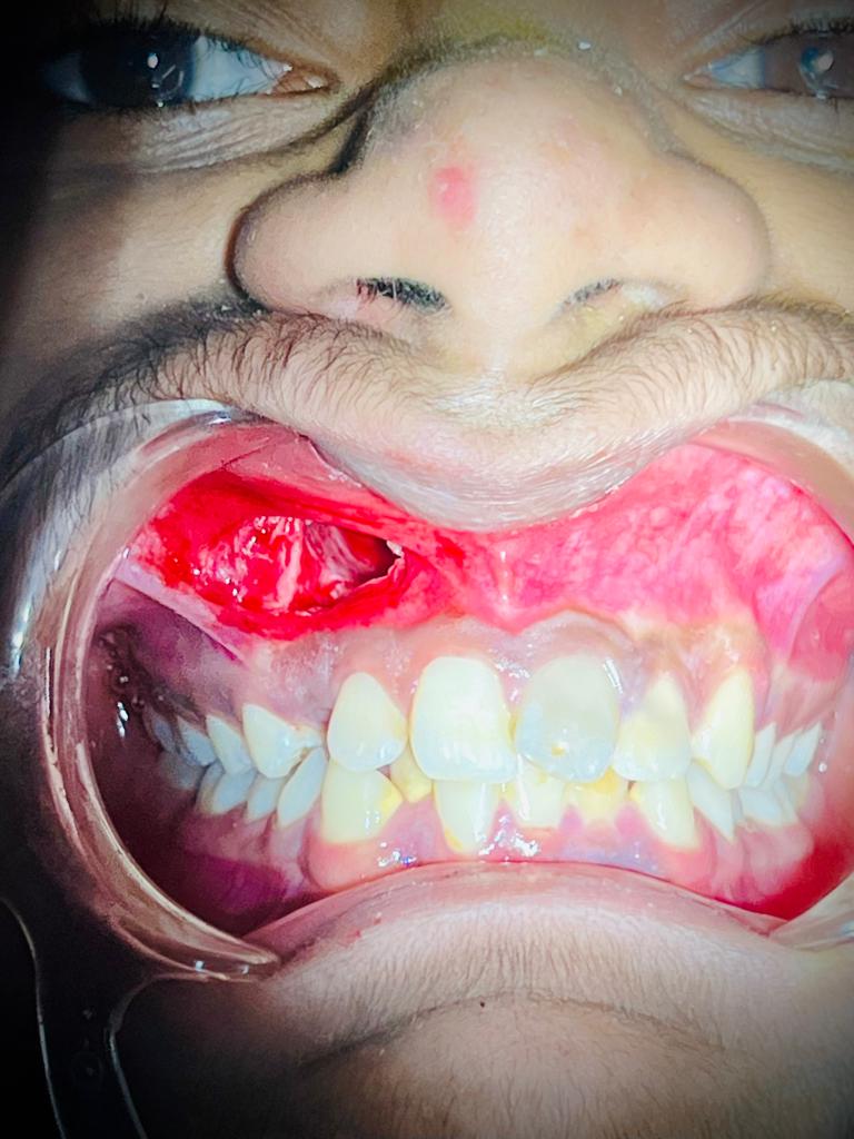 Treatment journey step 8 — Final result